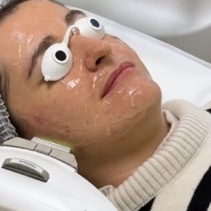 Центр косметології «Beauty Therapy», фото-2