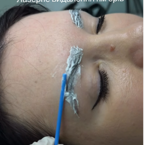 Центр косметології «Permamed beauty clinic», фото-1